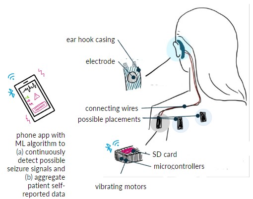 EBME 370 - Unobtrusive Ear-EEG for Long-Term Seizure Monitoring